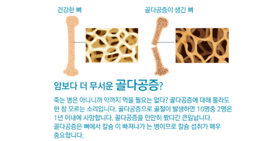 섭취보다 흡수... 나노칼슘 2
