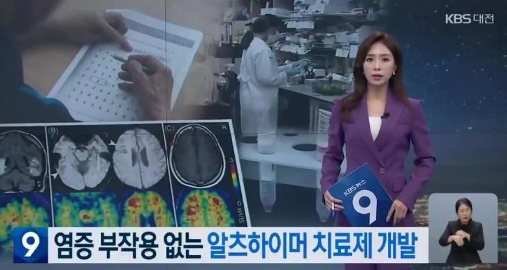  카이스트 치매 알츠하이머 치료제 개발 세계 최초