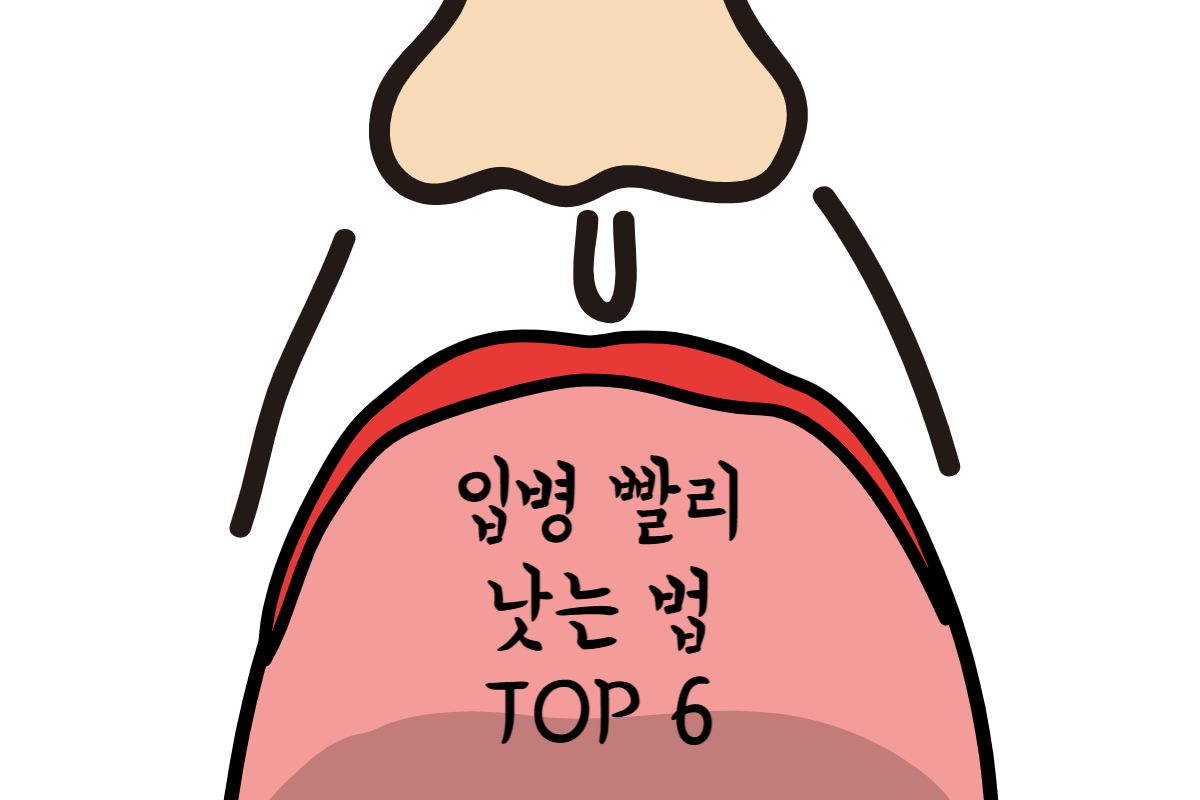 입병-빨리-낫는법