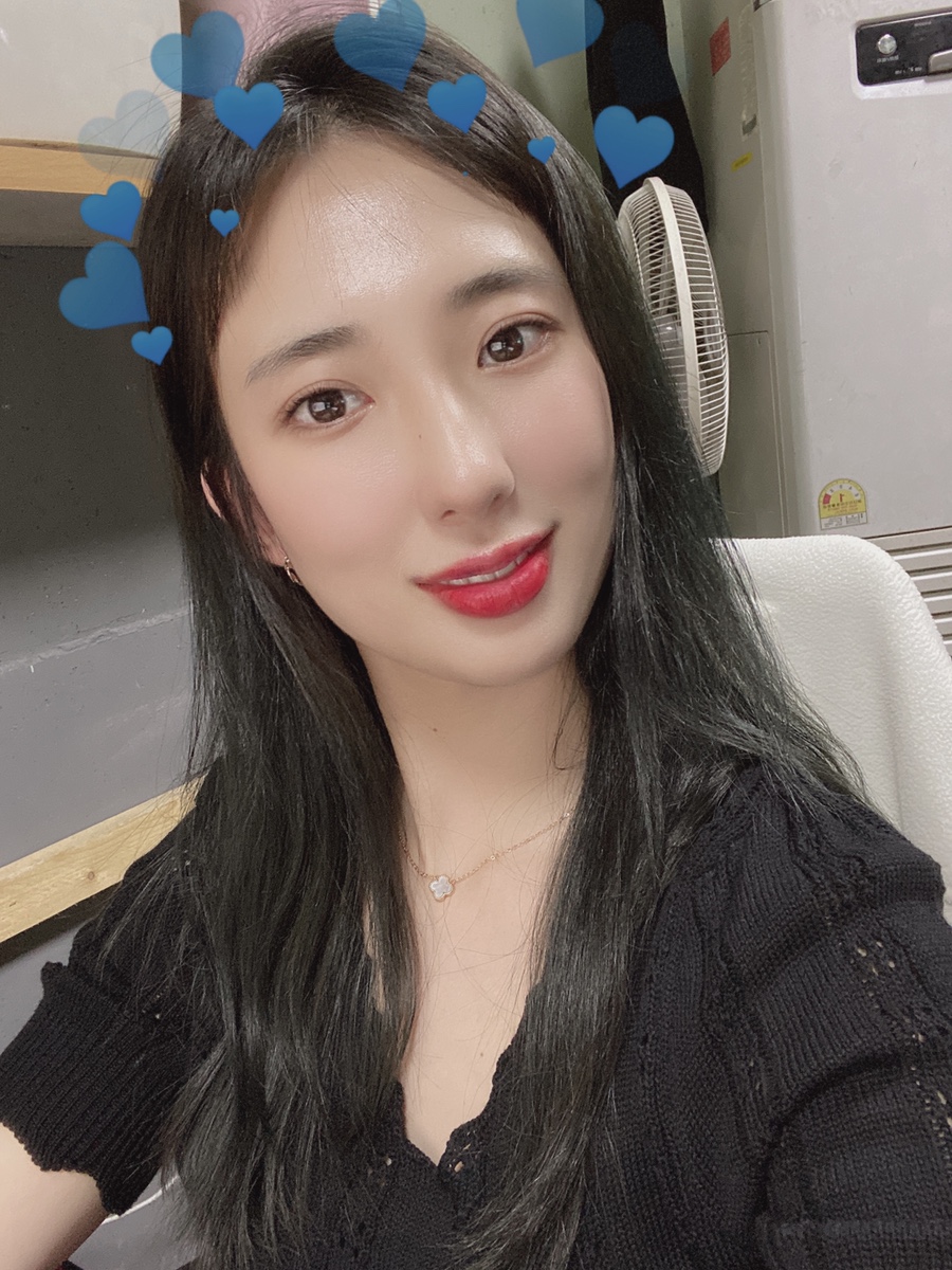 입술 보톡스 부작용 대전 입술필러+입꼬리보톡스 내돈내산 2