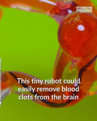 UTS, 뇌 제어 로봇공학 혁신 새로운 바이오센서 개발 ㅣ 로봇을 우리 뇌에 집어 넣을 수 있을까 Novel Biosensors Set to Revolutionize Brain-Controlled Robotics ㅣ VIDEO:Could robots get inside our brains?