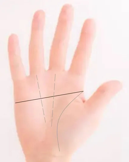 일자손금