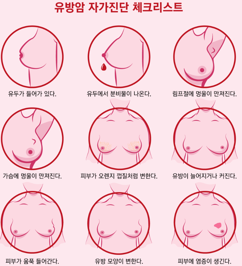 유방암체크