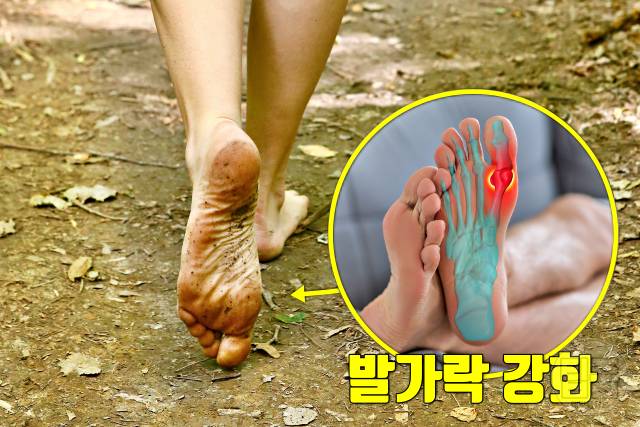 엄지발가락 옆 통증 건막류 치료 엄지발가락 휘어짐 맨발걷기