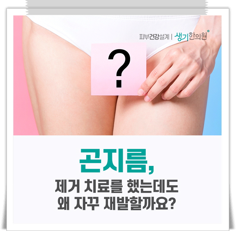 항문곤지름 8