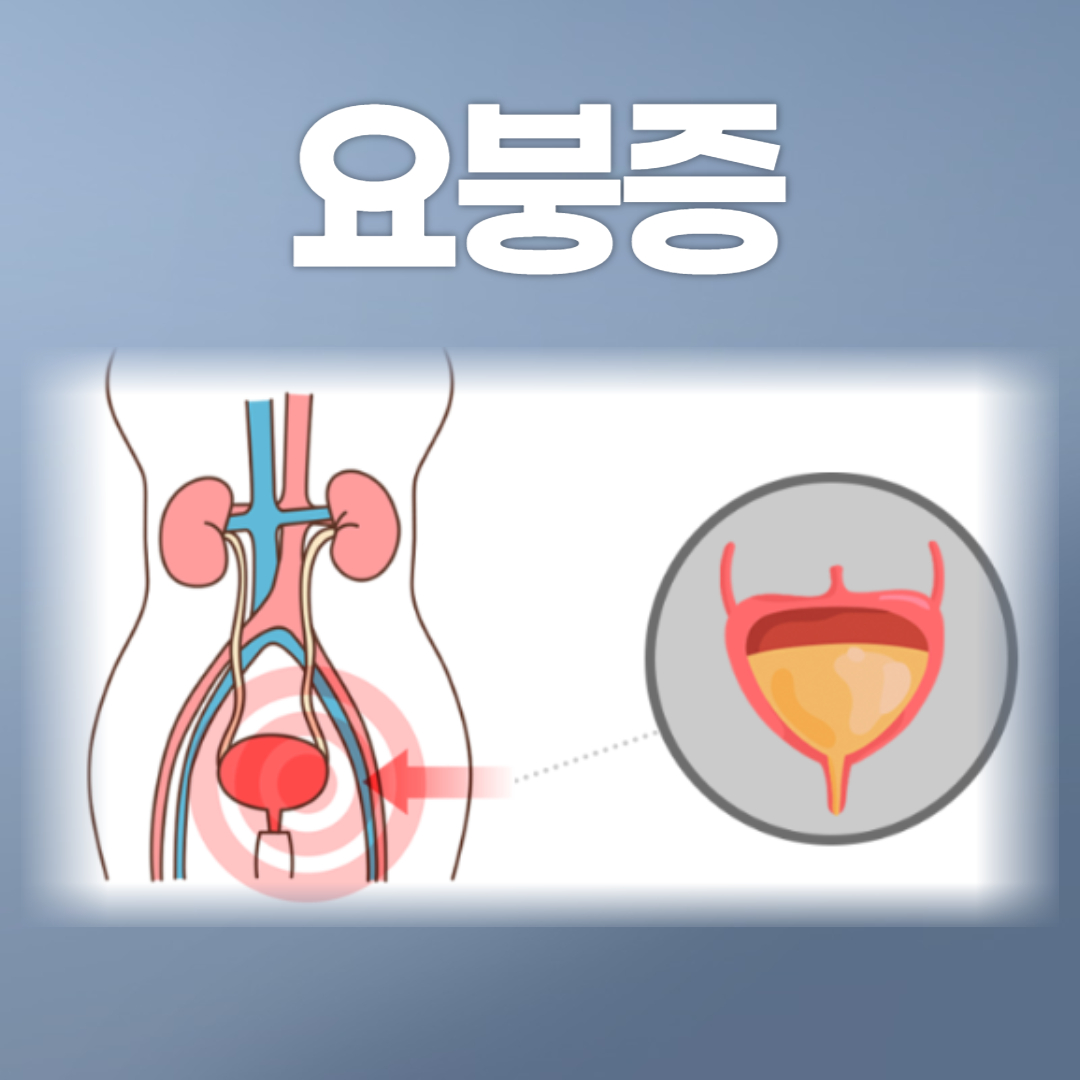 요붕증