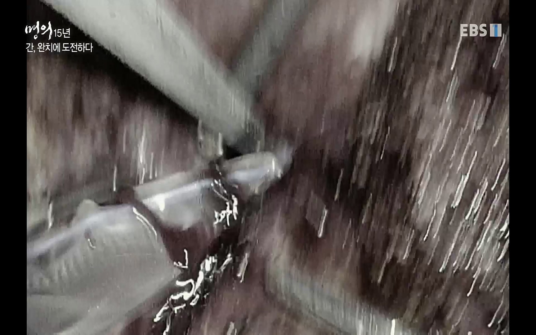 EBS 명의 헬스케어 - TV - 교육의 중심 EBS명의 15년 - 간, 완치에 도전하다.mp4_20220802_202421.991.jpg