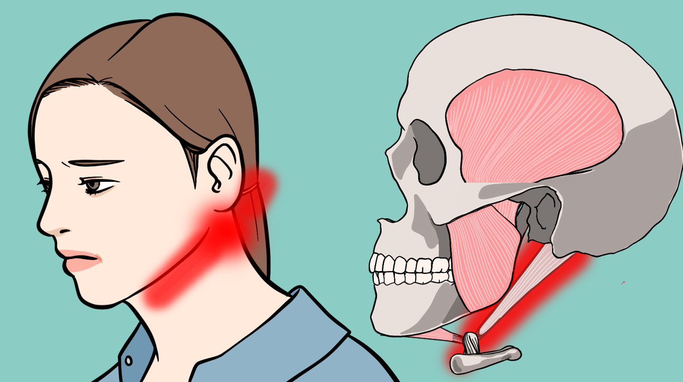 악이복근 방사통, 두힘살근 해부와 기능 통증, 구강내과의사가 알려드림.