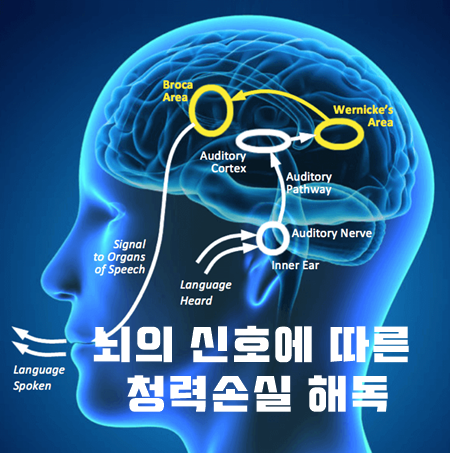  [연구] 뇌의 신호를 통한 청력 손실 해독 - 이편한보청기