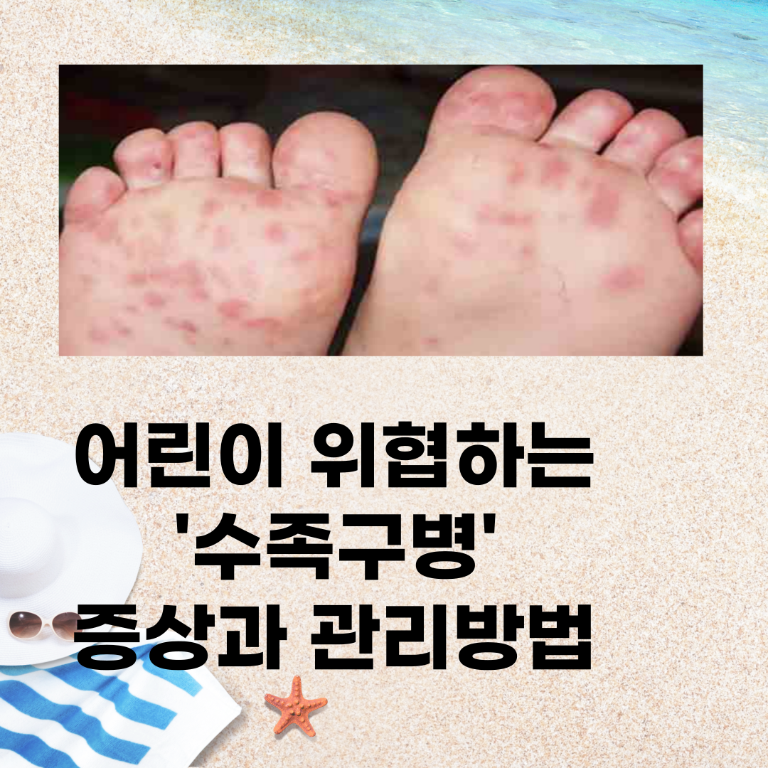  수족구병(HFMD) 증상과 자가관리 방법