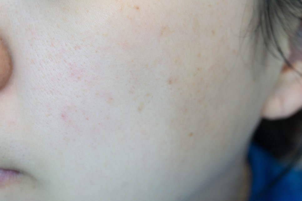 ginger 스킨케어의 시작은 이중기능성토너인 1