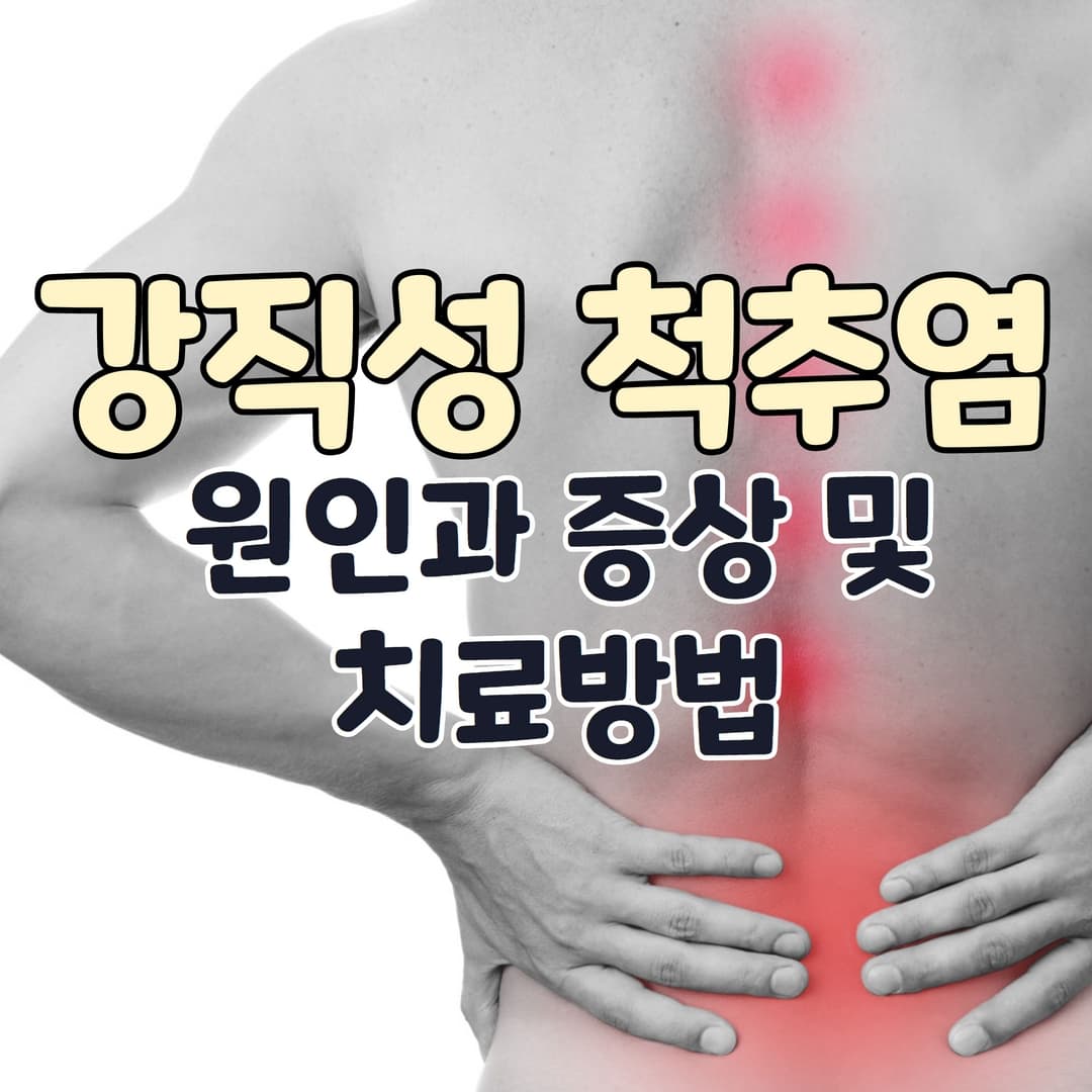  강직성 척추염의 원인과 증상 및 치료방법