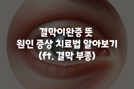 결막이완증