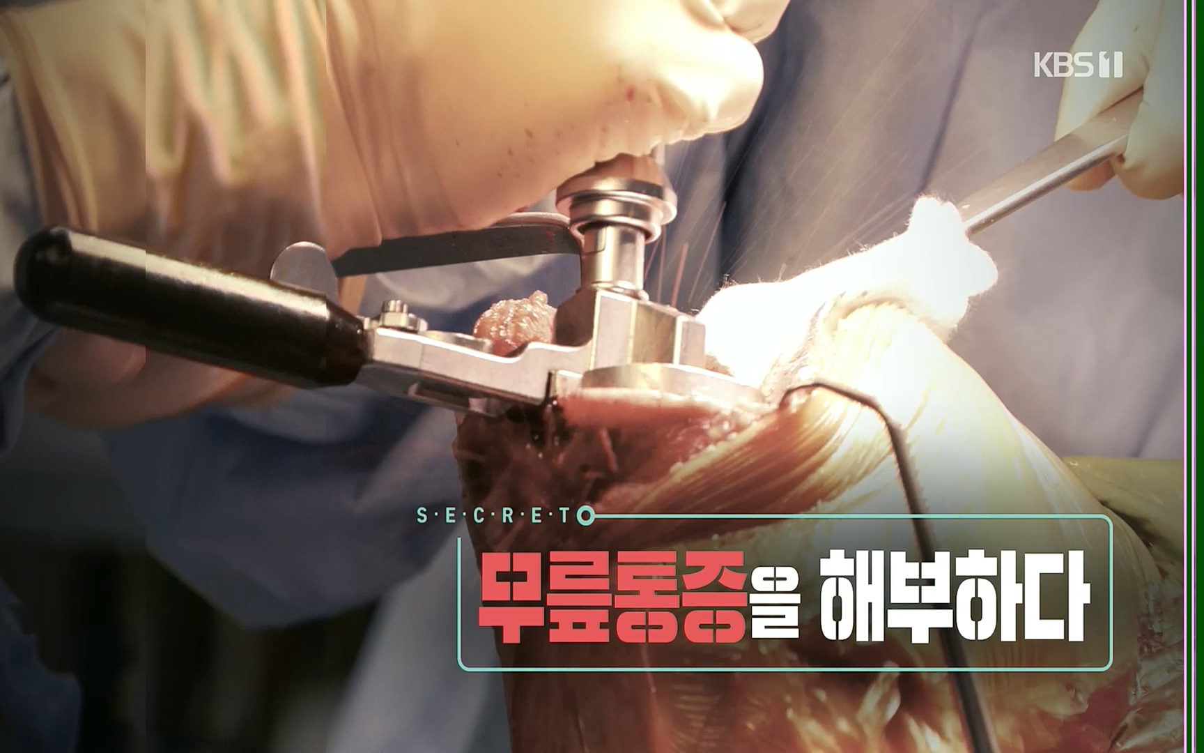 생로병사의 비밀.E834.220907p.H264-F1RST.mp4_20220908_204543.537.jpg