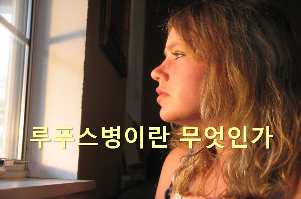  루푸스병이란 무엇이며? 루푸스병에 좋은 음식은?