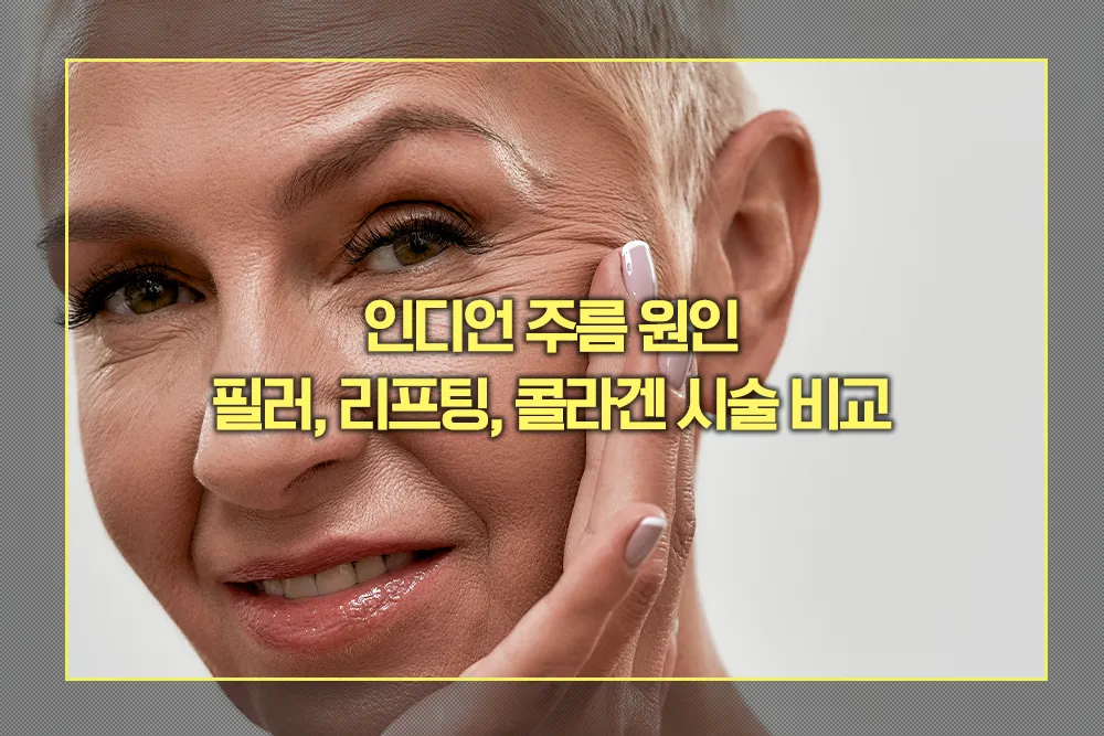 인디언 주름 필러, 리프팅, 콜라겐 시술