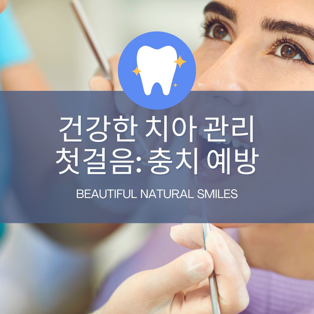 건강한 치아 관리 첫걸음: 충치 예방