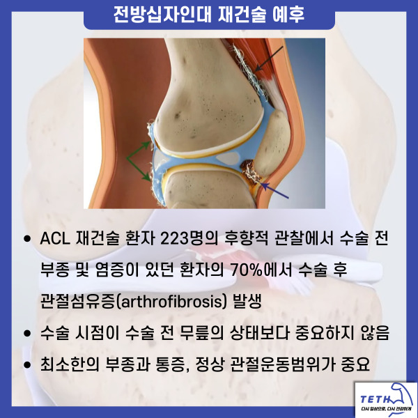 전방십자인대(16)