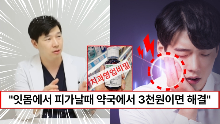 “치과에서도 결국 이걸로 해결합니다” 잇몸에서 피날때 약국에서 단돈 3천원으로 잇몸병 잡는법