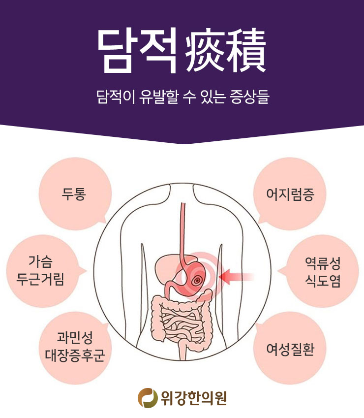 담적이 의심된다면 상복부 통증 6