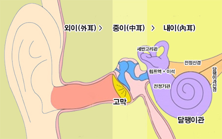 메니에르병 원인 내이의 세반고리관 , 전정기관 