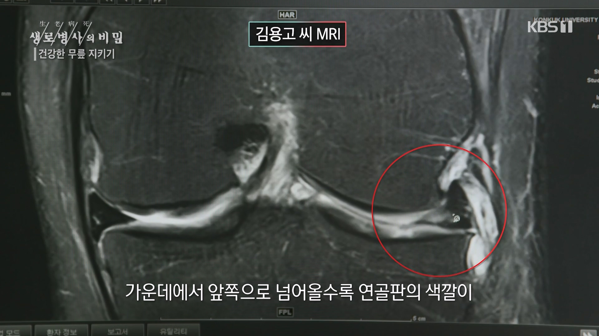 생로병사의 비밀.E873.230607p-NEXT.mp4_20230608_202208.437.jpg
