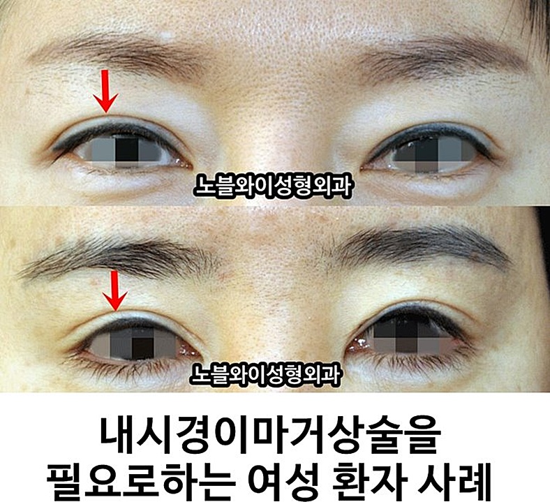  이마거상술잘하는곳 놀랄만한 변화들