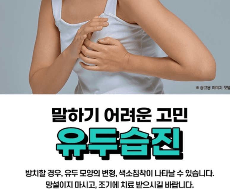 유두 습진 원인, 증상, 관리방법, 치료방법 총정리