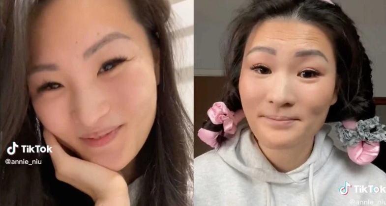 "쌍둥이 동생이 죽자" 할머니 알면 충격 받을까 봐 1인 2역 연기한 손녀딸의 슬픈 사연은…