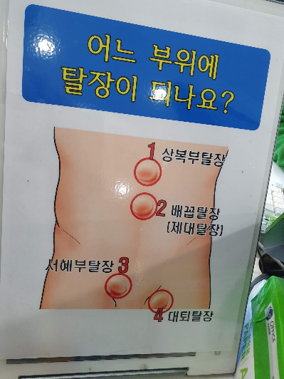 서혜부 탈장수술 리얼 후기