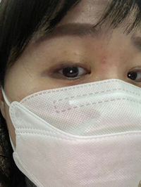 아이라인반영구 17