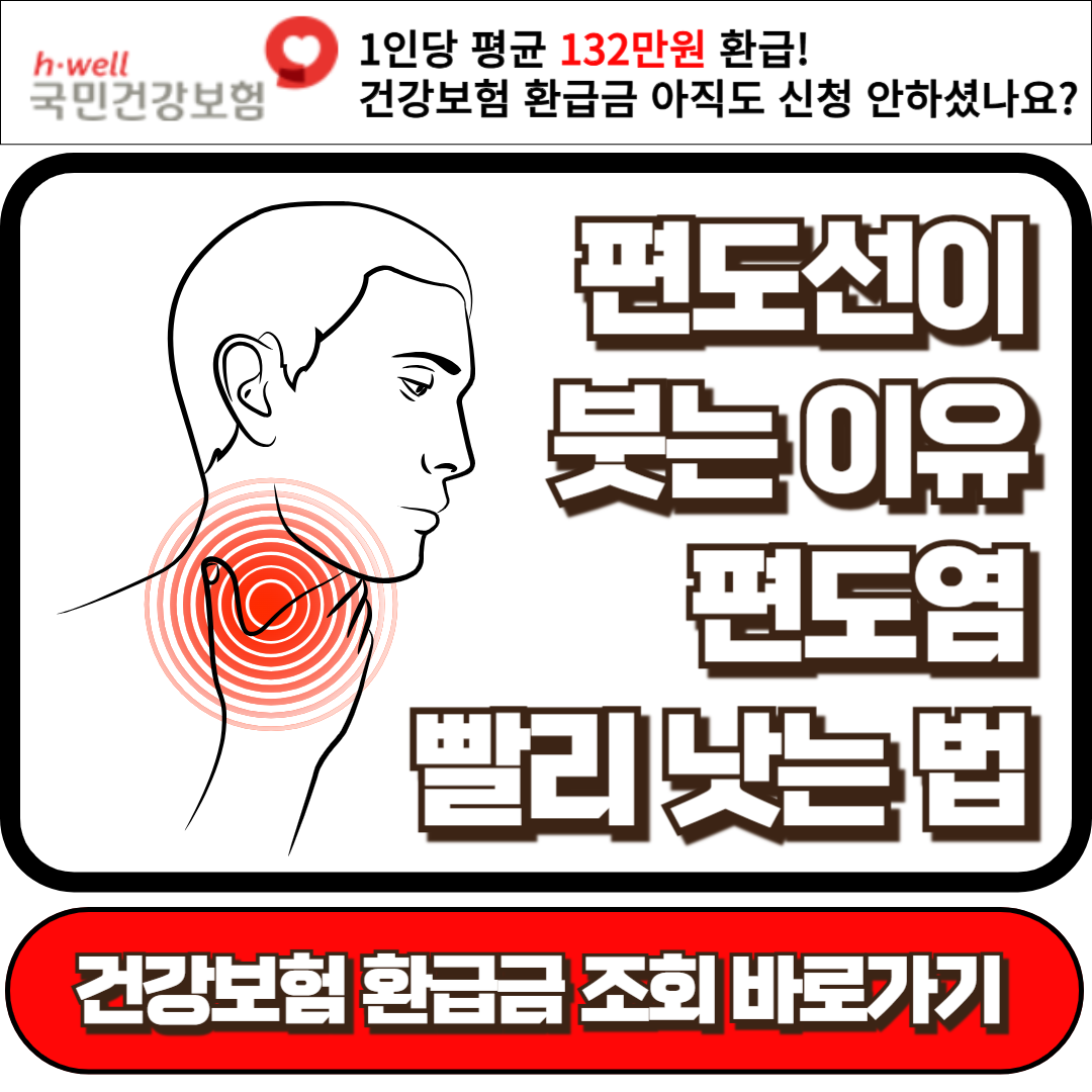 편도선이 붓는 이유, 편도염 빨리 낫는 법, 편도선염