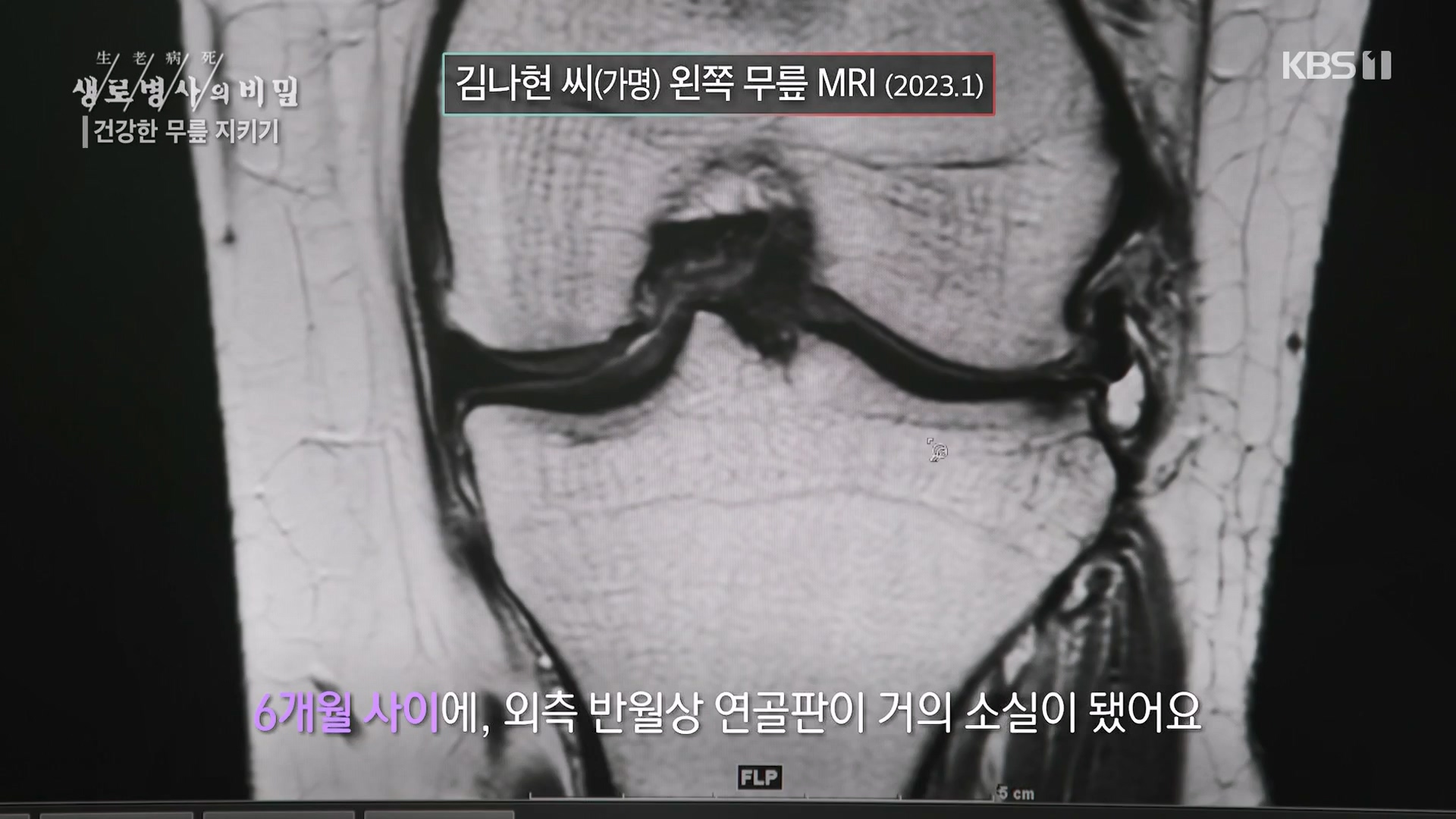생로병사의 비밀.E873.230607p-NEXT.mp4_20230608_202210.733.jpg
