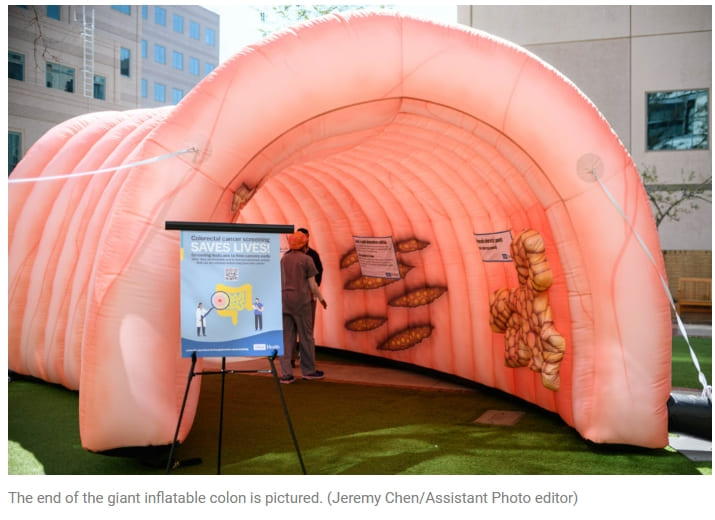 대장암의 가장 무서운 점은 UCLA Health walks community through risks, symptoms of colorectal cancer