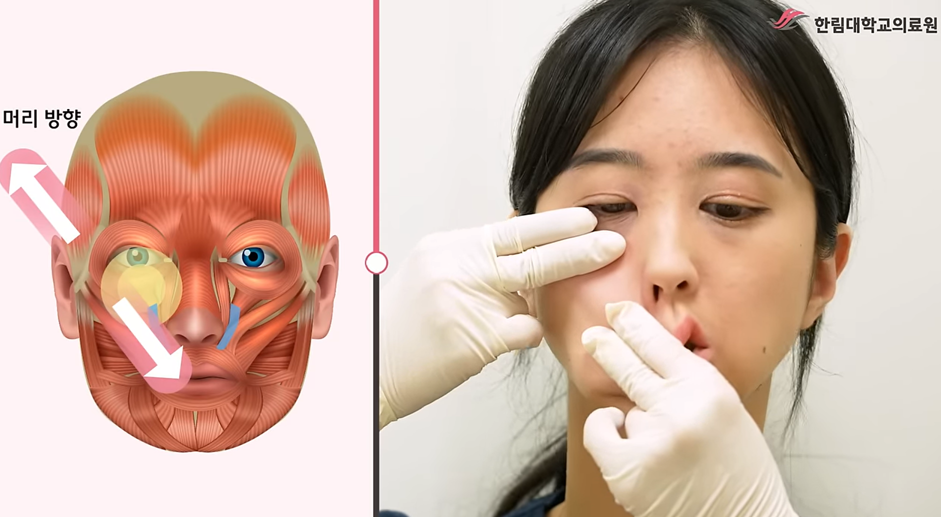 위입술올림근 스트레칭