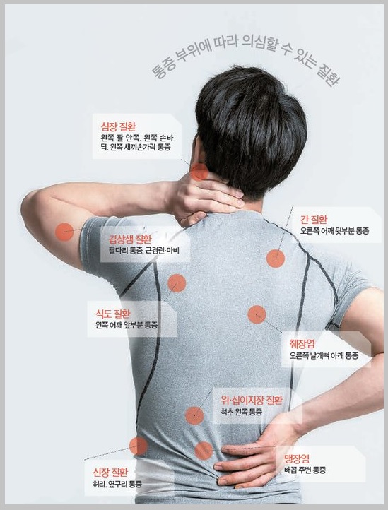 등 통증 부위에 따른 질환 종류