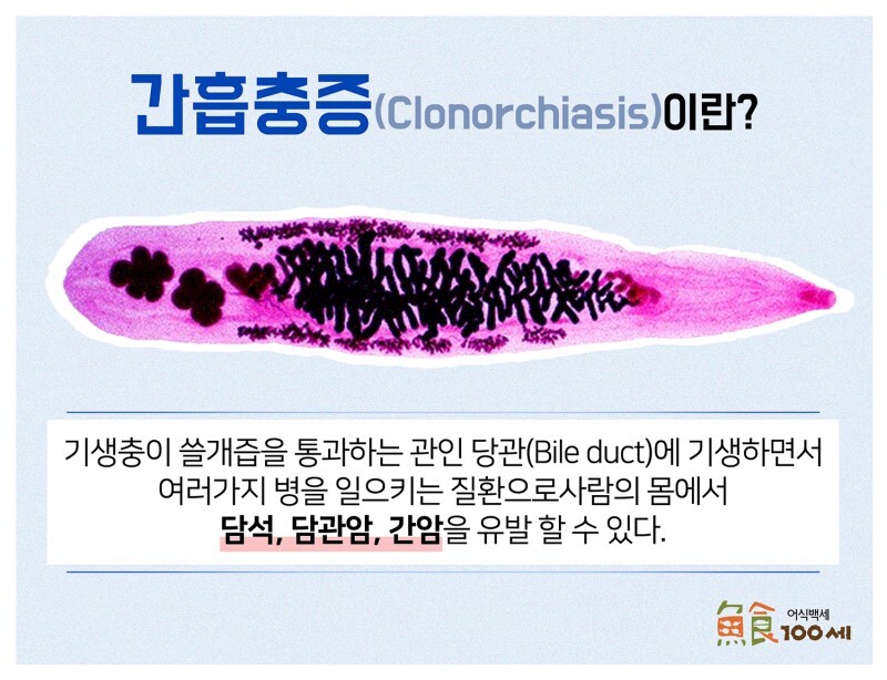  [ 4급법정감염병 ] 법정감염병 4급 쉽게 알아보고 끝내자~!!