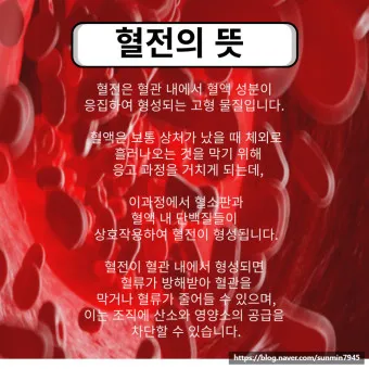 혈전 없애는 방법 혈전 증상 용해제 부작용_21