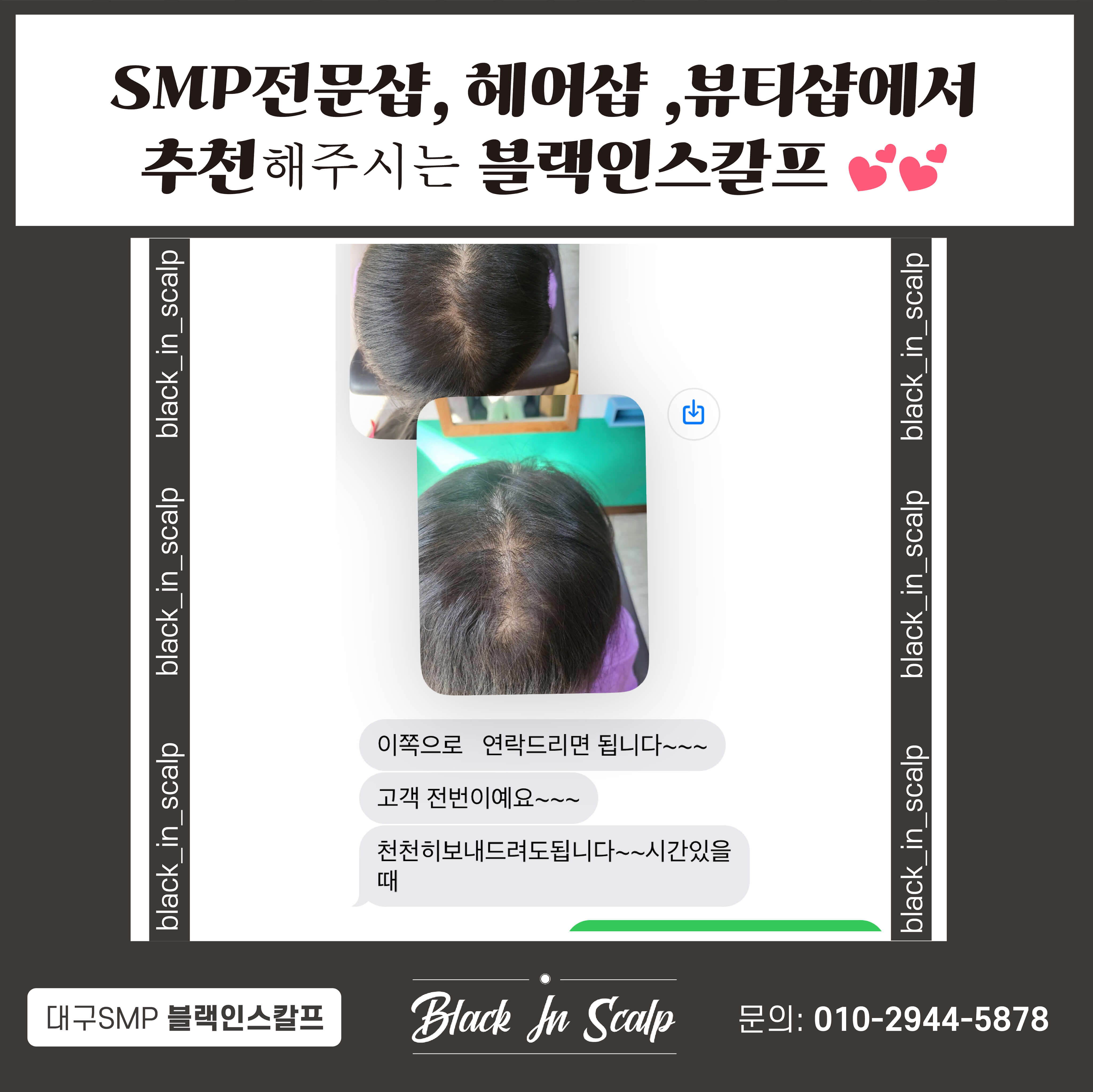 블랙인스칼프 이미지