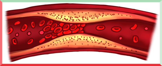  혈전에 좋은 음식 (뇌졸중, 심장마비를 유발합니다)