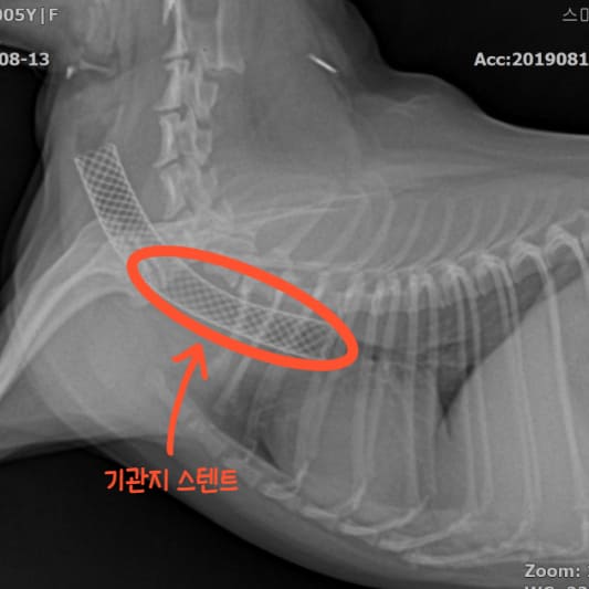 강아지-기관지-스텐트
강아지-기관지스텐트
강아지-기관지스텐트-삽입