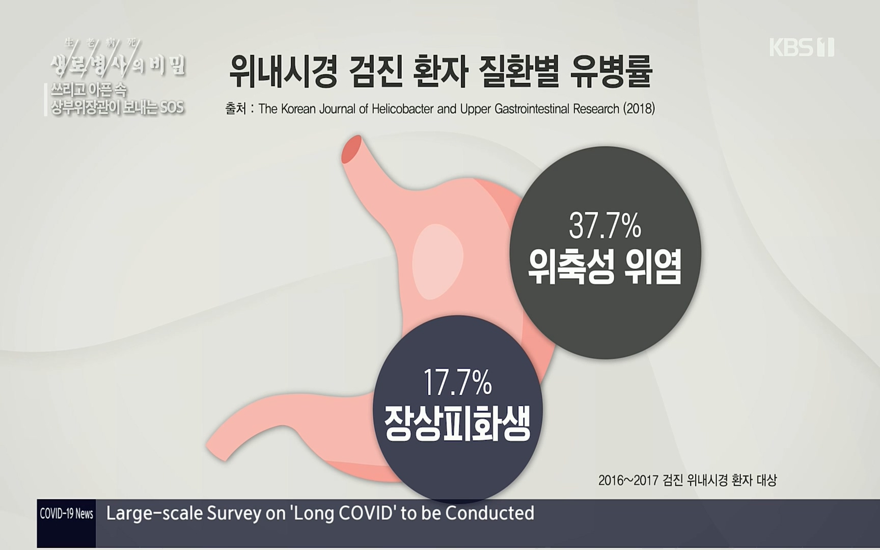 생로병사의 비밀.E822.220615p.H264-F1RST.mp4_20220616_203134.697.jpg