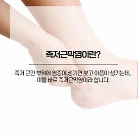  족저 근막염 원인 증상 치료법