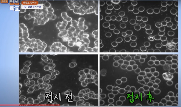 전지-전과후-혈액-비교