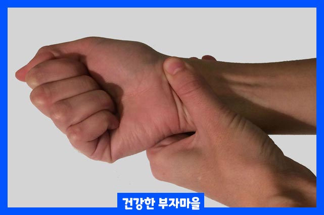 Carpal tunnel syndrome 증상