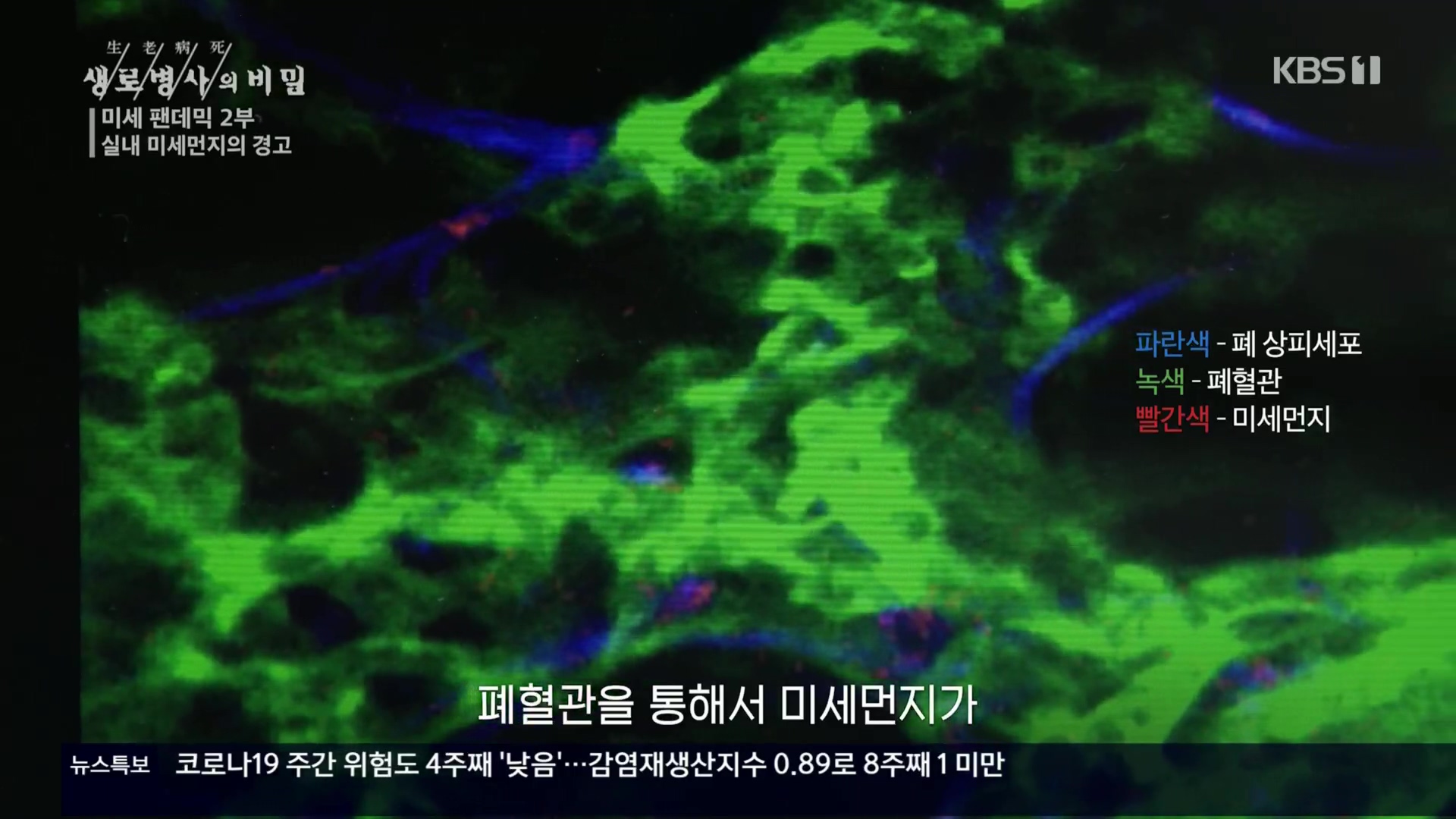 생로병사의 비밀.E840.221019p.H264-F1RST.mp4_20221020_175131.666.jpg