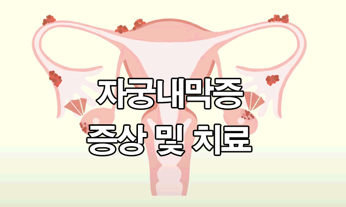  자궁내막증 증상 : 치료