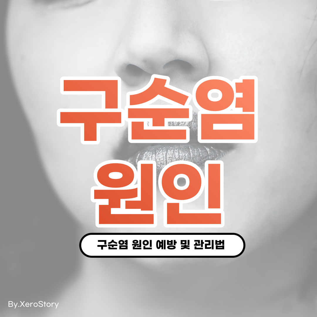 입술각질 염증 구순염의 원인과 증상 예방법에 대하여