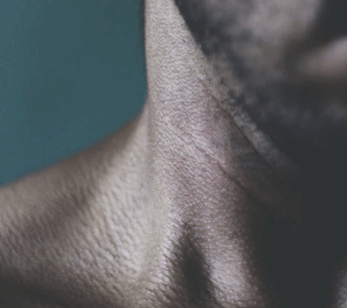 경추디스크 증상 human neck image 18