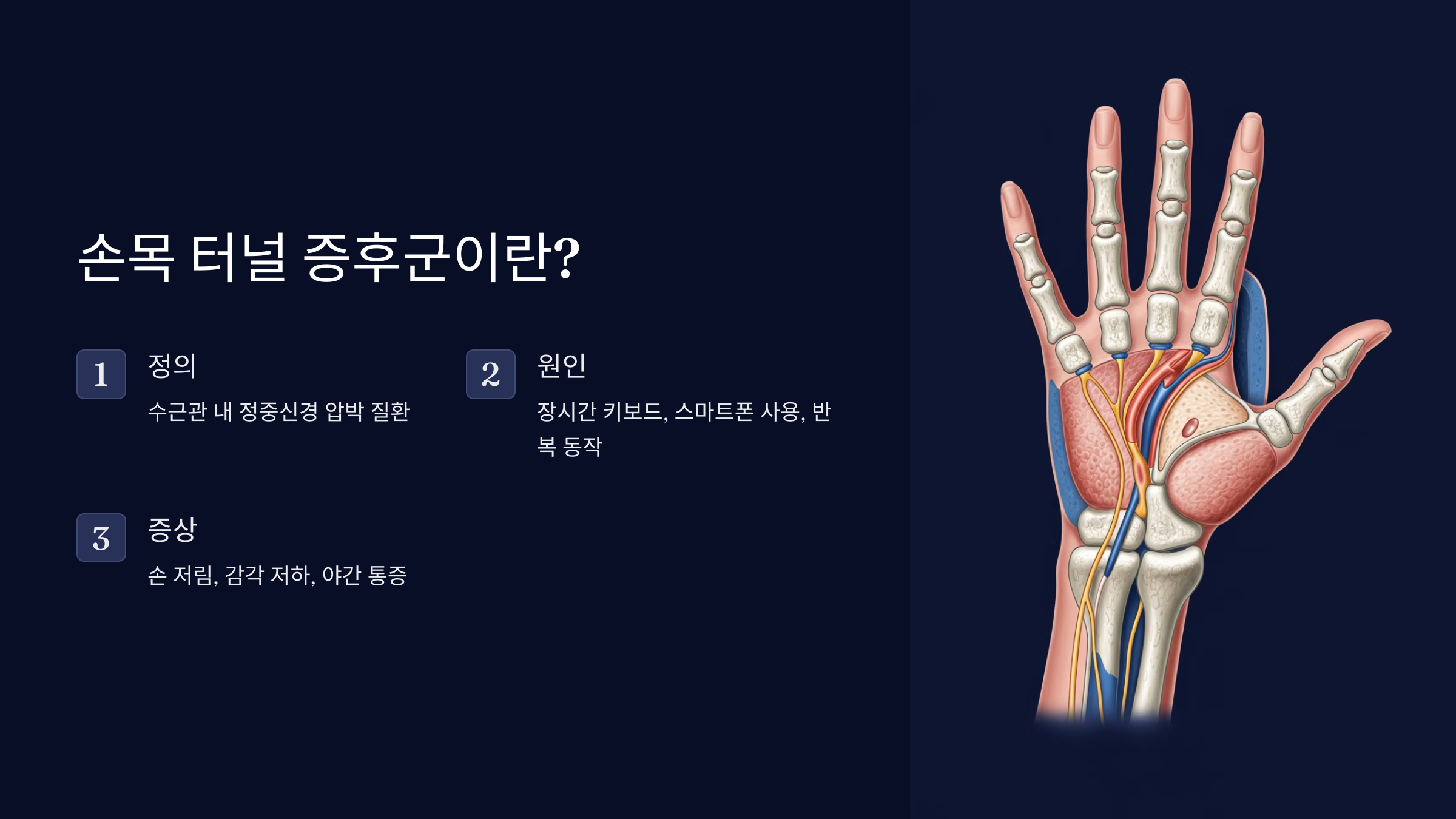 1. 손목 터널 증후군이란?